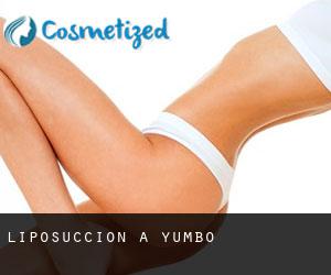 Liposuccion à Yumbo