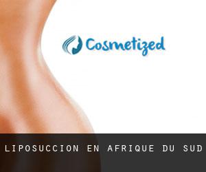 Liposuccion en Afrique du Sud Liposuccion en Afrique du Sud