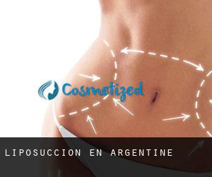 Liposuccion en Argentine