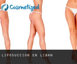 Liposuccion en Liban