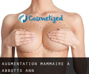 Augmentation mammaire à Abbotts Ann