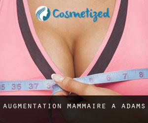 Augmentation mammaire à Adams Augmentation mammaire à Adams