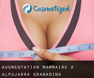 Augmentation mammaire à Alpujarra Granadina Augmentation mammaire à Alpujarra Granadina