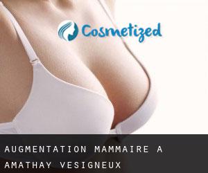 Augmentation mammaire à Amathay-Vésigneux
