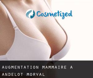 Augmentation mammaire à Andelot-Morval