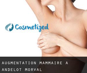 Augmentation mammaire à Andelot-Morval