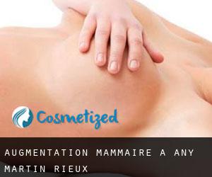 Augmentation mammaire à Any-Martin-Rieux