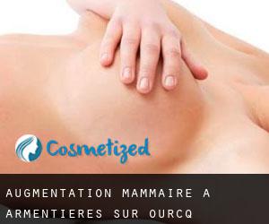 Augmentation mammaire à Armentières-sur-Ourcq