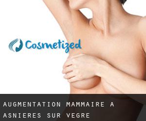 Augmentation mammaire à Asnières-sur-Vègre