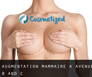 Augmentation mammaire à Avenue B and C
