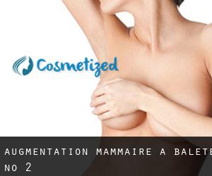 Augmentation mammaire à Balete No 2