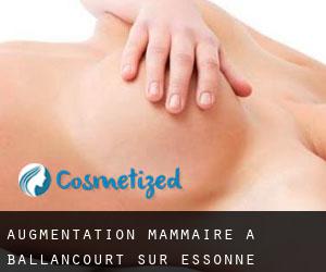 Augmentation mammaire à Ballancourt-sur-Essonne