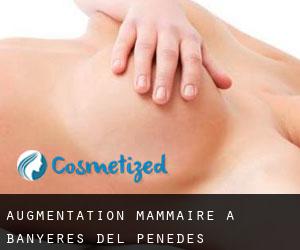 Augmentation mammaire à Banyeres del Penedès