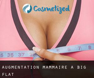 Augmentation mammaire à Big Flat