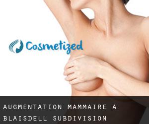 Augmentation mammaire à Blaisdell Subdivision