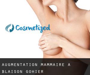 Augmentation mammaire à Blaison-Gohier