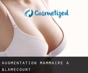 Augmentation mammaire à Blamécourt