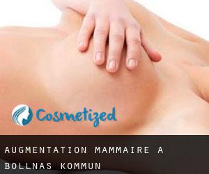 Augmentation mammaire à Bollnäs Kommun