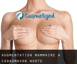 Augmentation mammaire à Cadagmayan Norte