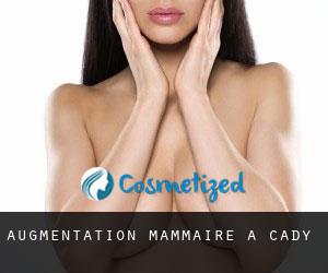 Augmentation mammaire à Cady