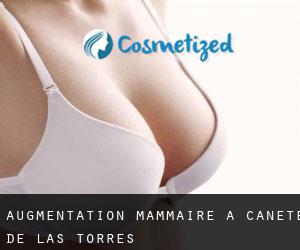 Augmentation mammaire à Cañete de las Torres
