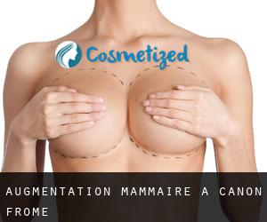 Augmentation mammaire à Canon Frome