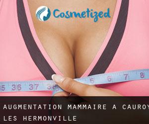 Augmentation mammaire à Cauroy-lès-Hermonville