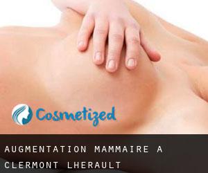 Augmentation mammaire à Clermont-l'Hérault
