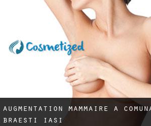 Augmentation mammaire à Comuna Brăeşti (Iaşi)