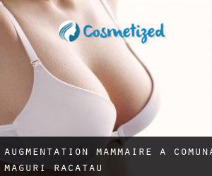 Augmentation mammaire à Comuna Mãguri-Rãcãtãu