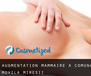 Augmentation mammaire à Comuna Movila Miresii
