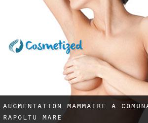 Augmentation mammaire à Comuna Rapoltu Mare