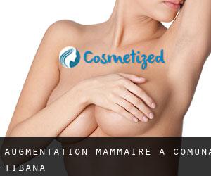 Augmentation mammaire à Comuna Ţibana