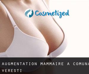 Augmentation mammaire à Comuna Vereşti