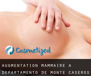 Augmentation mammaire à Departamento de Monte Caseros