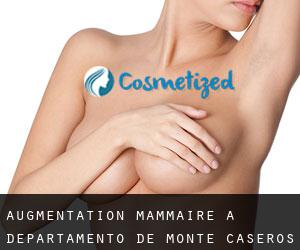 Augmentation mammaire à Departamento de Monte Caseros