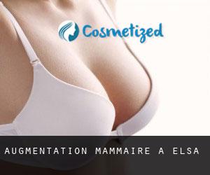 Augmentation mammaire à Elsa Augmentation mammaire à Elsa