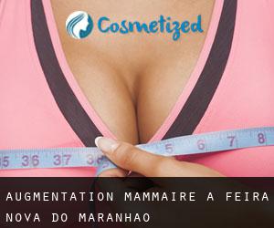 Augmentation mammaire à Feira Nova do Maranhão