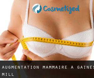 Augmentation mammaire à Gaines Mill