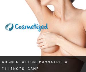 Augmentation mammaire à Illinois Camp