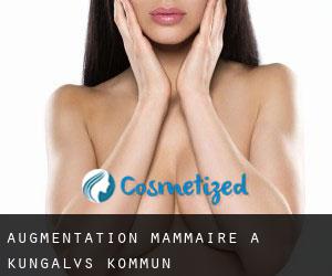Augmentation mammaire à Kungälvs Kommun
