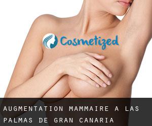 Augmentation mammaire à Las Palmas de Gran Canaria