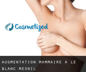 Augmentation mammaire à Le Blanc-Mesnil