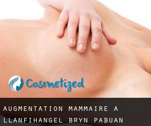 Augmentation mammaire à Llanfihangel-Bryn-Pabuan