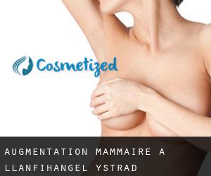 Augmentation mammaire à Llanfihangel-Ystrad