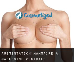 Augmentation mammaire à Macédoine-Centrale