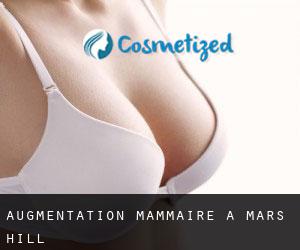 Augmentation mammaire à Mars Hill