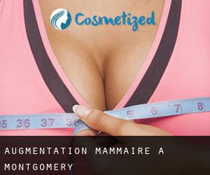 Augmentation mammaire à Montgomery Augmentation mammaire à Montgomery