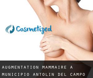 Augmentation mammaire à Municipio Antolín del Campo