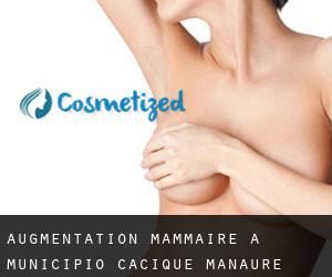 Augmentation mammaire à Municipio Cacique Manaure